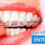 95% de descuento en guarda dental + limpieza ultrasónica en Cuponatic